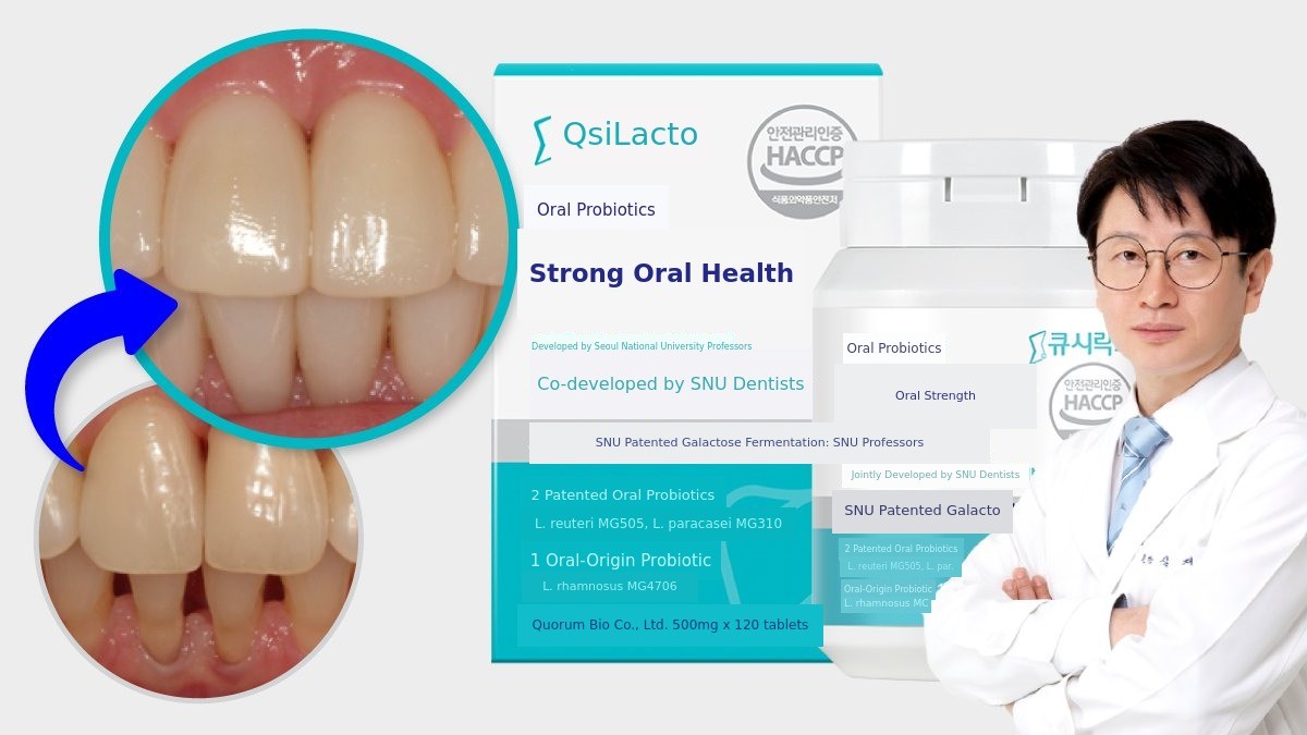 [Coupang's No.1 Oral Probiotic] Developed by Seoul National University Strengthen Your Gums & Freshen Breath