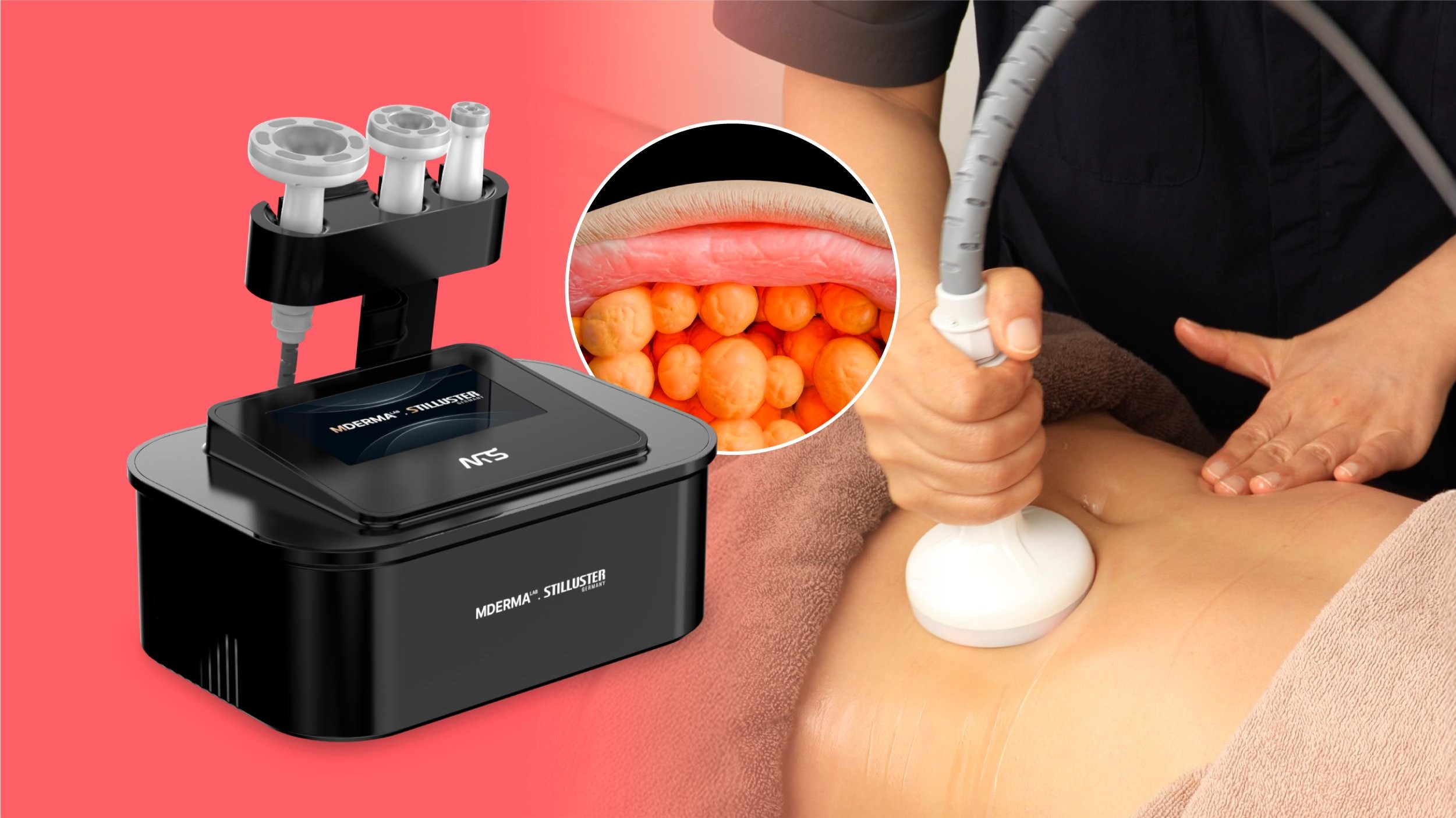 [For Cheongdam Aesthetic] Full Mode to Break Down and Melt Fat｜Unlimited Fat Suction + Radio Frequency