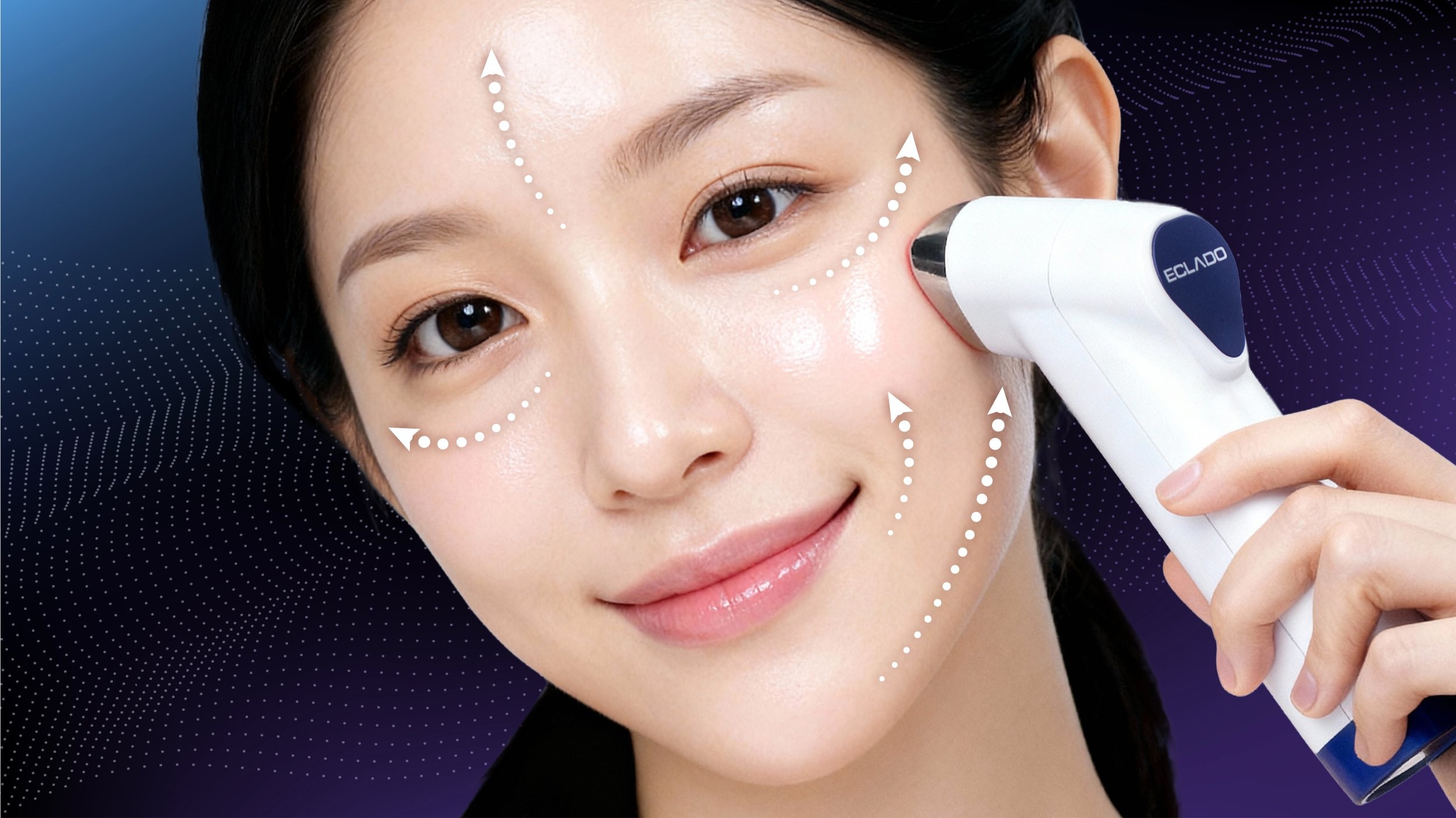 Fill and lift your mid-face volume with RF radiofrequency + EP fusion | Selvix Pro