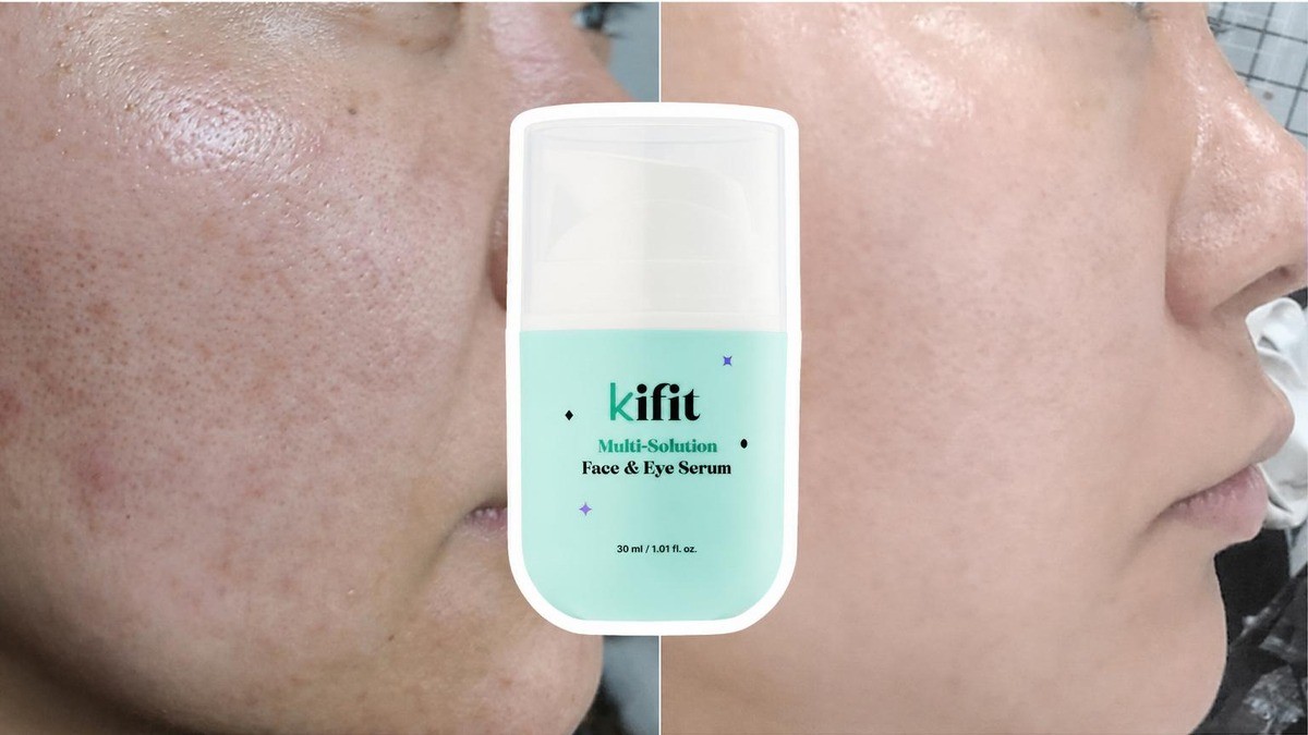 Reversed to Perfection: The 9-Billion-Won Developer’s 5-in-1 Serum Now Renewed!