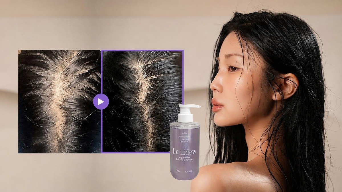 [Developed by Female Herbalist] Reduce Hair Loss by 62% with This Women's Hair Growth Shampoo