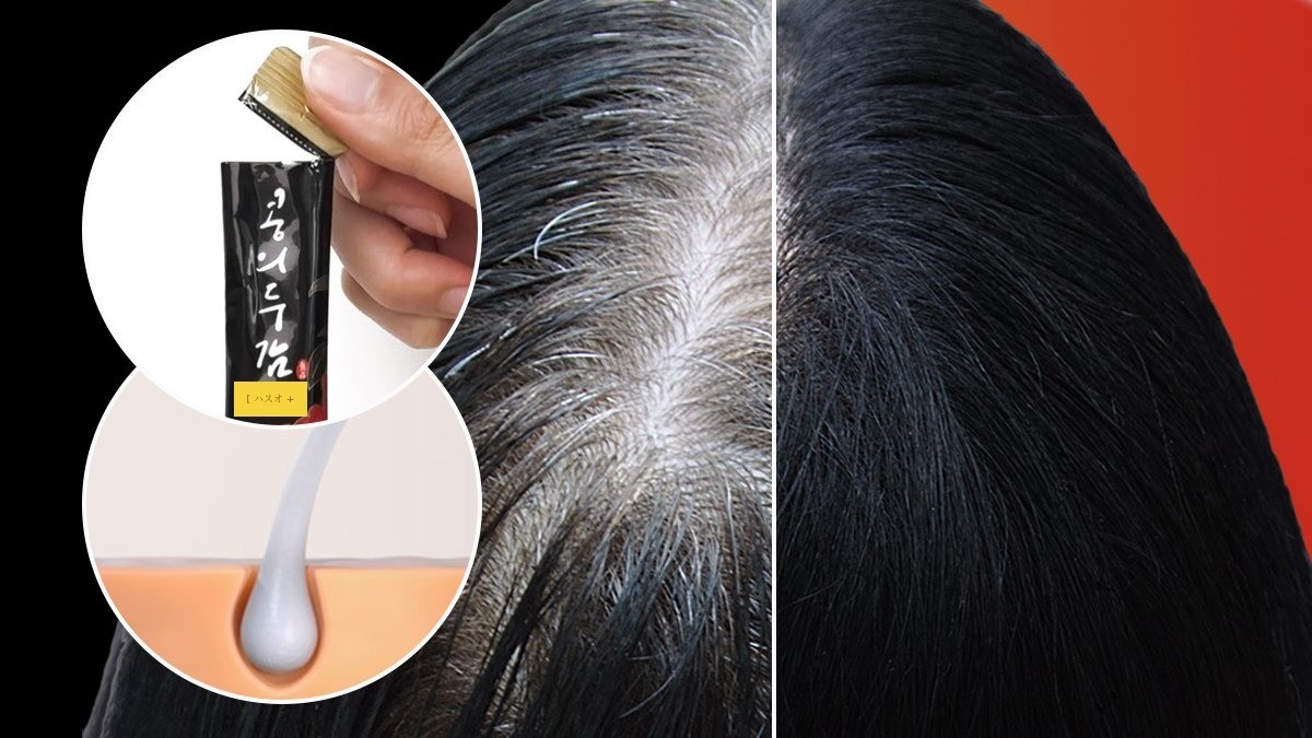 <白髪脱出> 脱毛コミュニティで大騒ぎのハスオって何？ 白髪はもう生えません