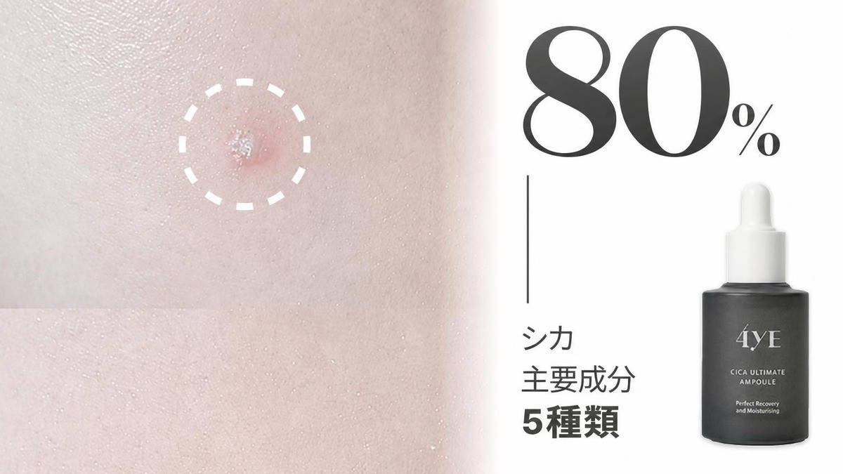 女性の永遠の悩み！あの日の肌トラブルに効くアンプル