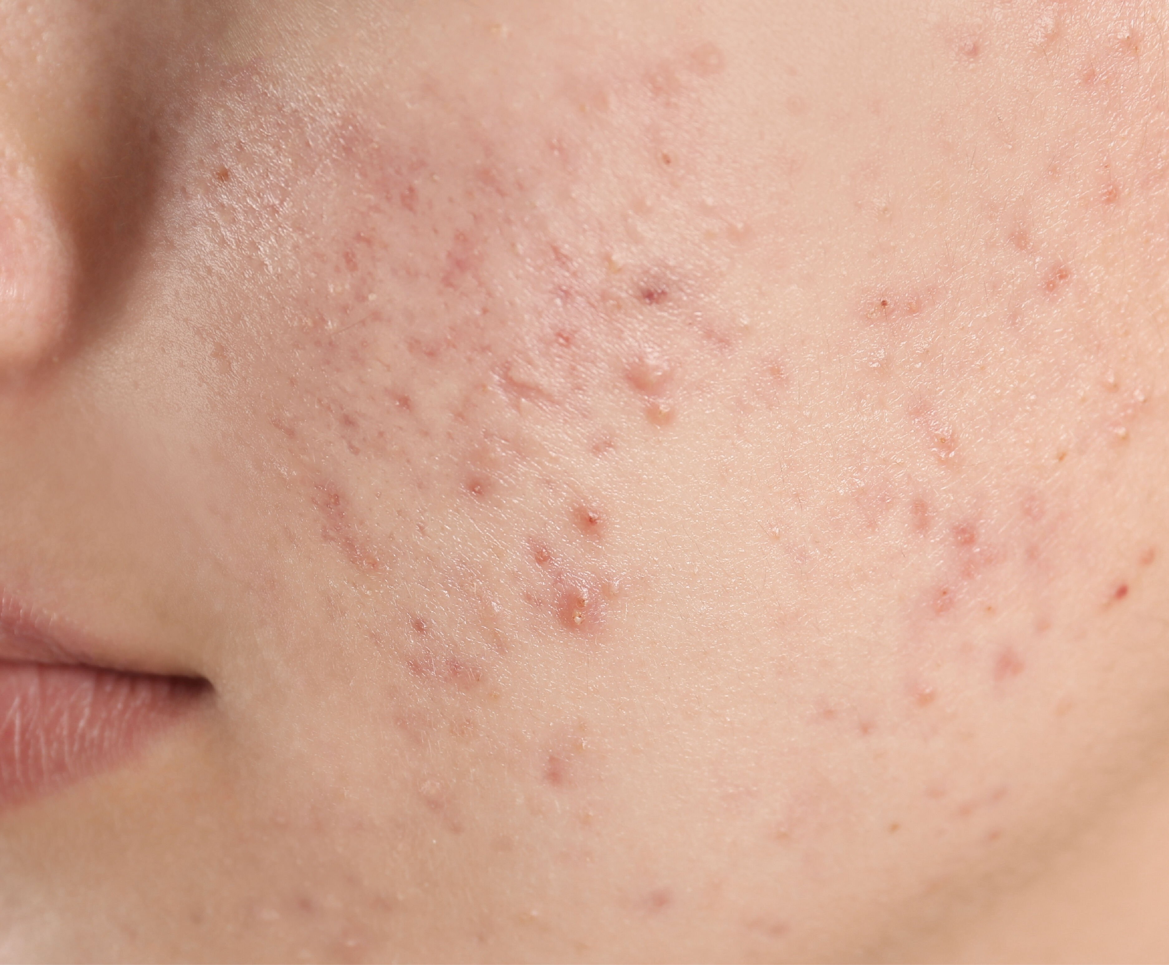 수건한번_작업중 (1)-03.jpg