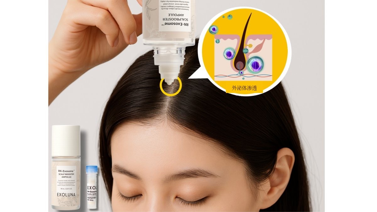 抑制脱发基因90%，经实证有效的美发精华液Exoluna脱发安瓶